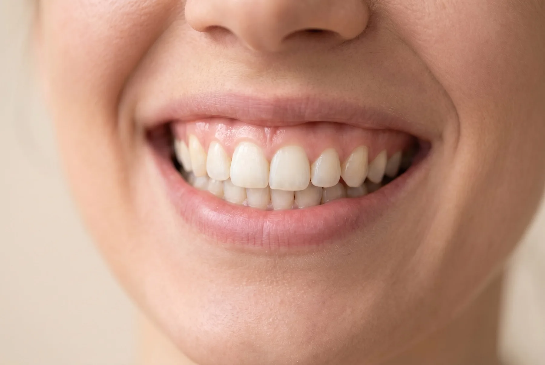 A smile with a balanced, even gum line