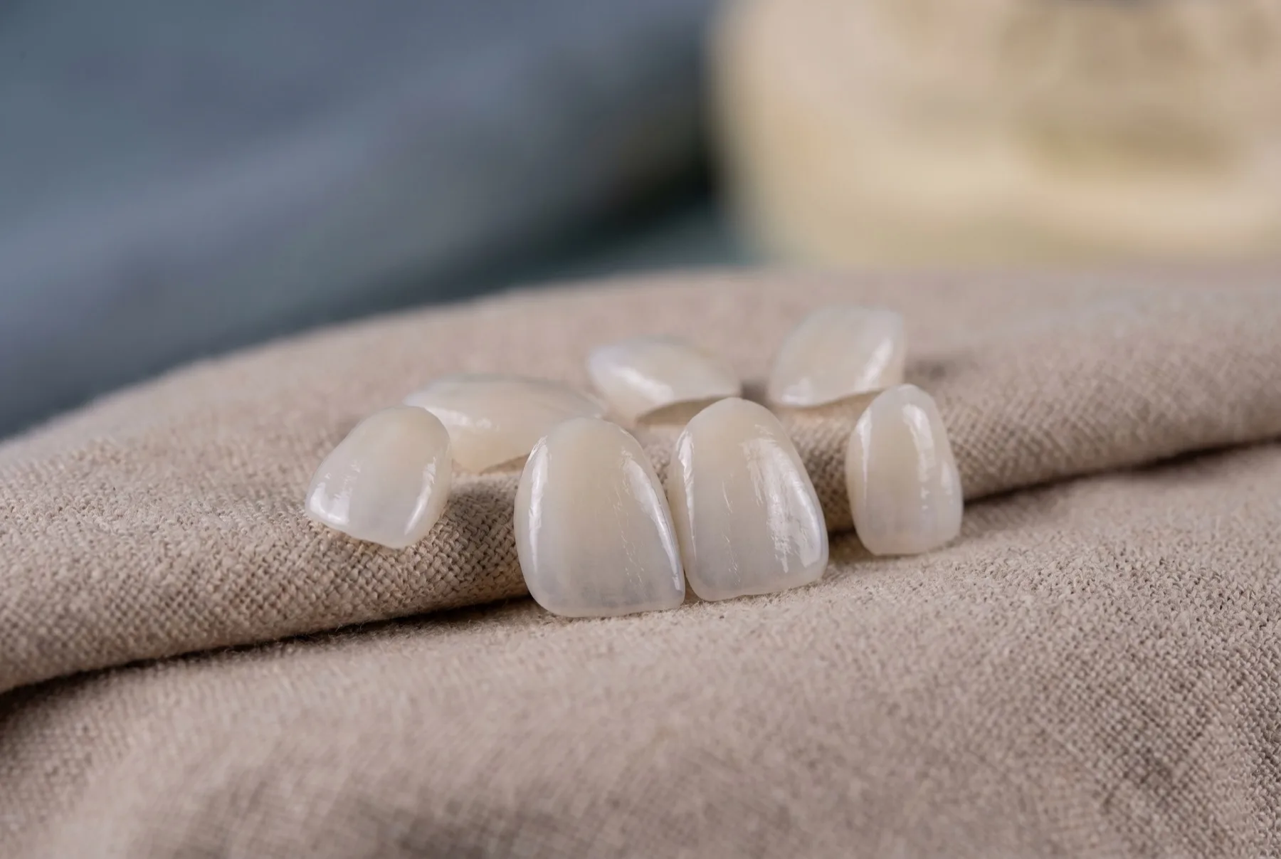 Ultra-thin porcelain veneers